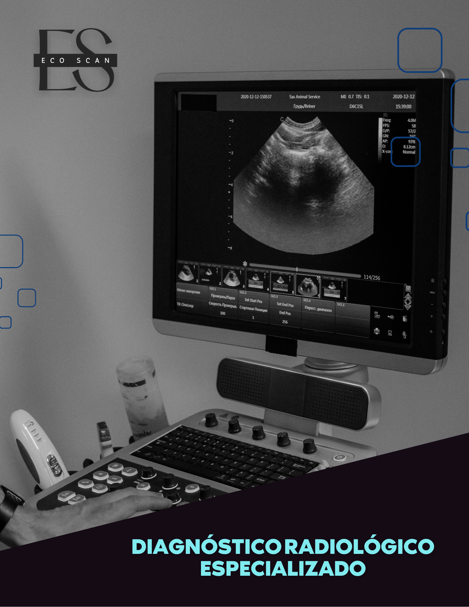 Imagen ilustrativa de otros estudios de ultrasonido