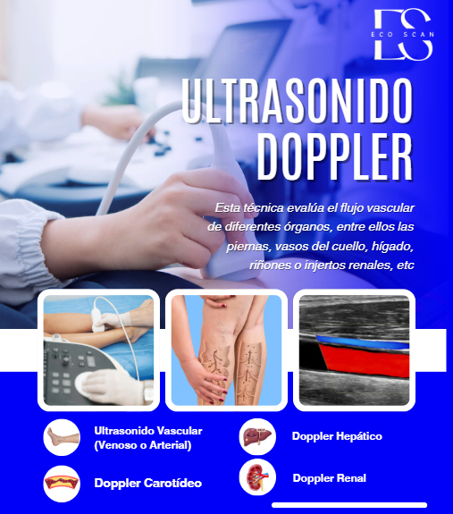 Imagen ilustrativa de ultrasonido Doppler arterial, venoso y obstétrico